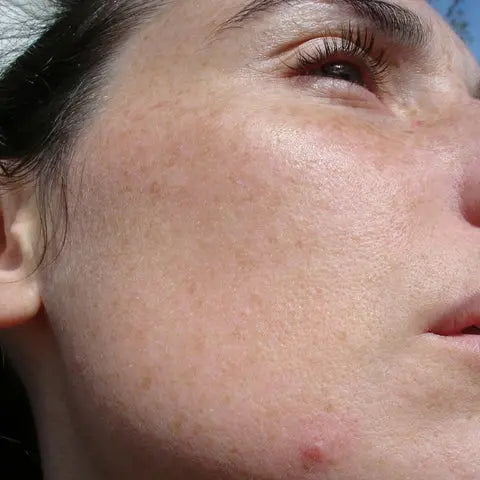 Nourishing-Your-Skin-During-Winter-Tips-for-Dry-Dehydrated-and-Mature-Skin Pals Skin Lab