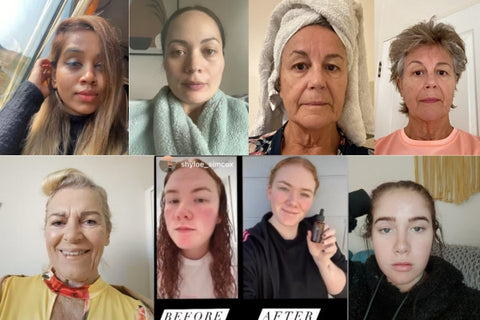 Pals_Skin_Lab_Real_Reviews