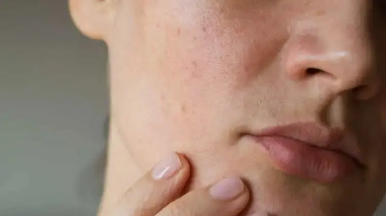 Balancing-Act-Your-Comprehensive-Skincare-Routine-for-Combination-Skin Pals Skin Lab