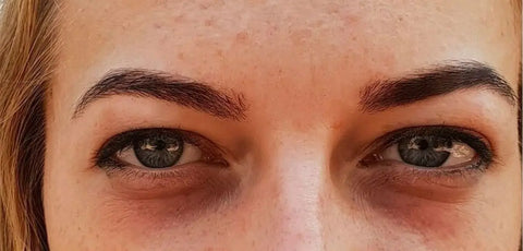 Brighten-Up-How-to-Get-Rid-of-Dark-Circles-with-Ease Pals Skin Lab