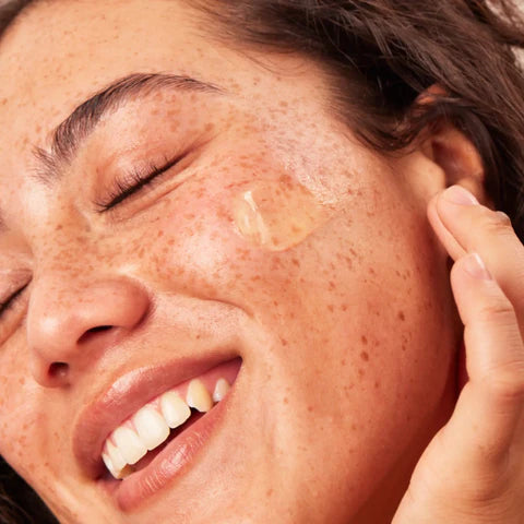 Vitamin C for Hyperpigmentation: A Comprehensive Guide