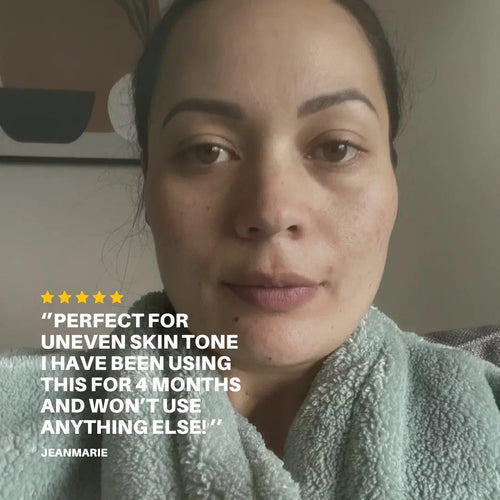 20% Vitamin C Serum Pal's Skin Lab