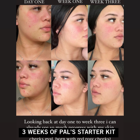 Pal's Skin Lab customer testimonials - real results from our affordable skincare products