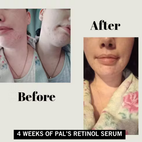 Pal's Skin Lab customer testimonials - real results from our affordable skincare products