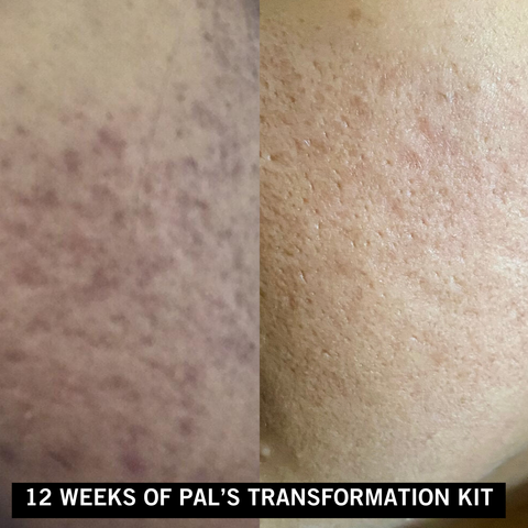 Pal's Skin Lab customer testimonials - real results from our affordable skincare products