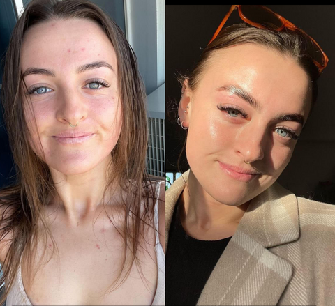 Pal's Skin Lab customer testimonials - real results from our affordable skincare products