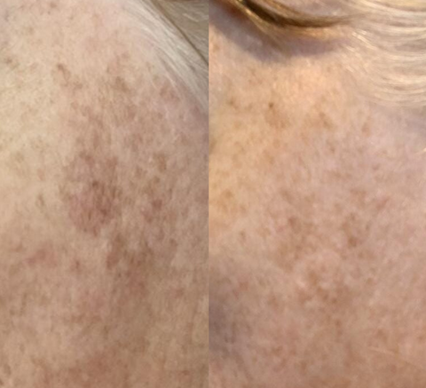 Pal's Skin Lab customer testimonials - real results from our affordable skincare products