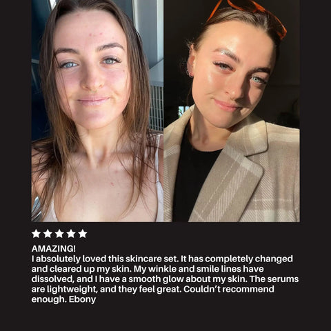 Transformation Kit Pal's Skin Lab