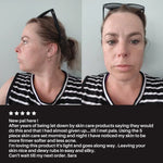 Transformation Kit Pal's Skin Lab