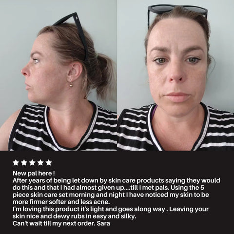 Transformation Kit Pal's Skin Lab